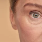 Best Eye Cream for Puffy Dark Circles in 2026 best eye cream for puffy dark circles