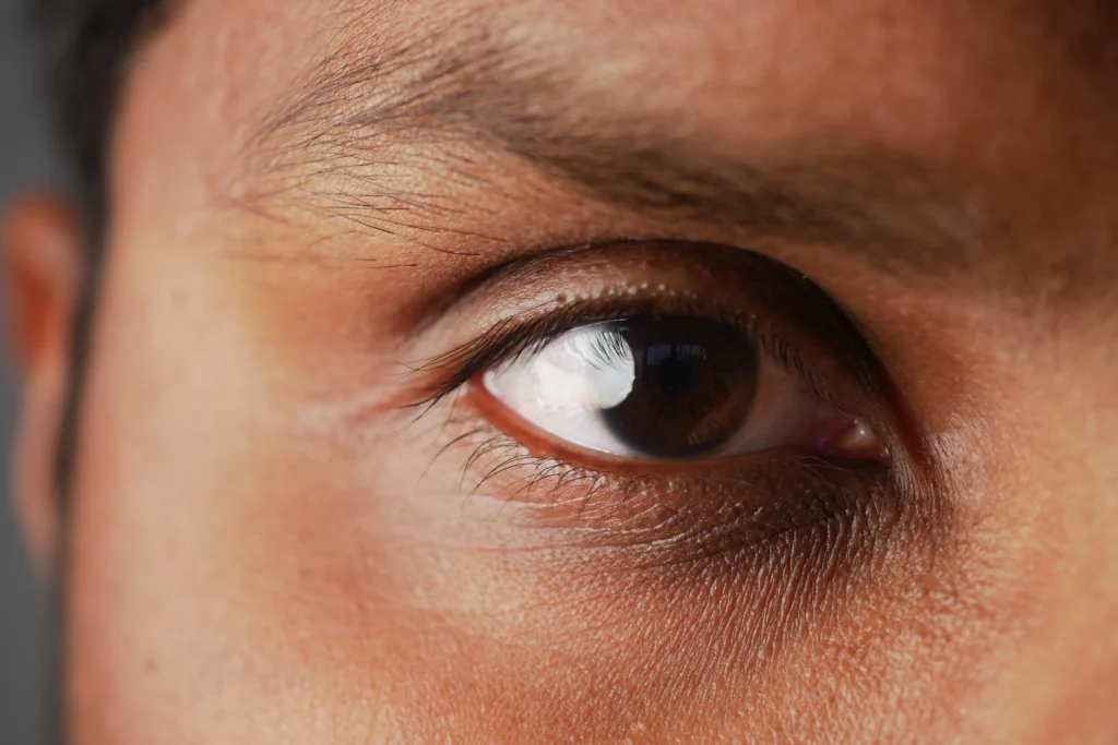 hydrating eye cream for dark circles