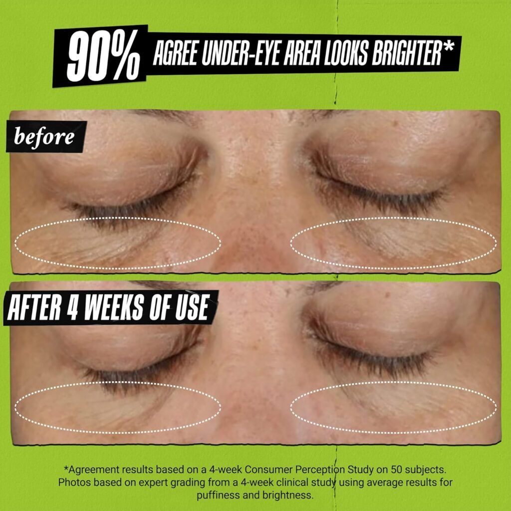 moisturizing eye cream for dark circles (2)