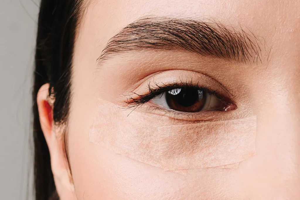 Periorbital Dark Circles Causes 2026: Science + Fixes periorbital dark circles (5)