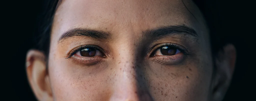 what does dark circles under eyes mean