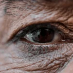 are dark circles genetic