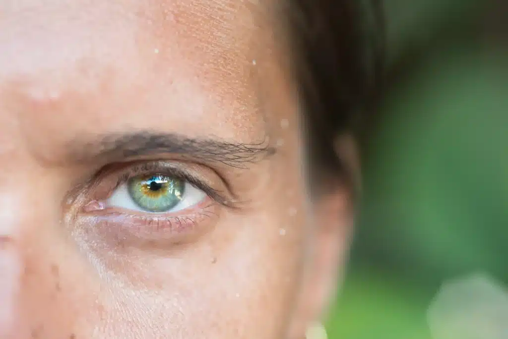 cream for sunken eyes