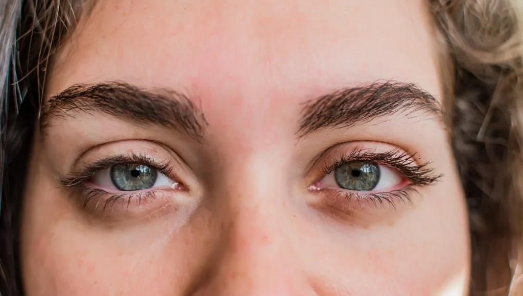 Why Do I Have Dark Circles Under My Eyes? (And How to Finally Get Rid of Them) why do i have dark circles under my eyes